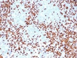 TdT Mouse anti-Human, Clone: rDNTT/6909, Novus Biologicals 100 &mu;g; Unconjugated:Antibodies,
